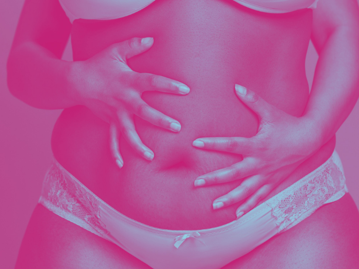 postnataler bauch schwangerschaft dehnungsstreifen