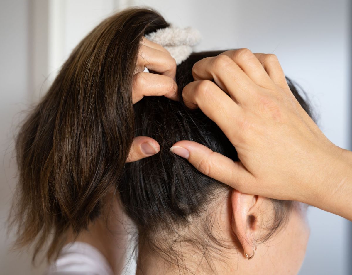 Fettige Haare? Hände weg von deiner Kopfhaut!