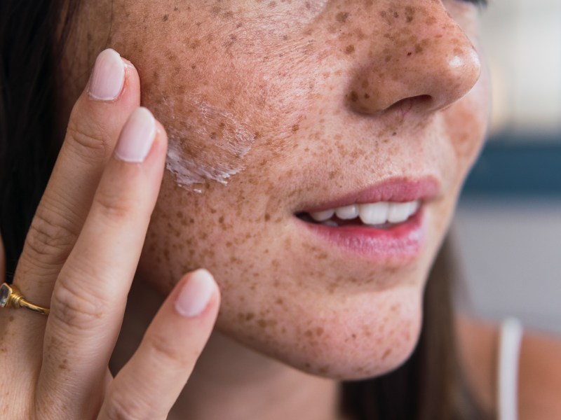 Frau trägt Creme auf